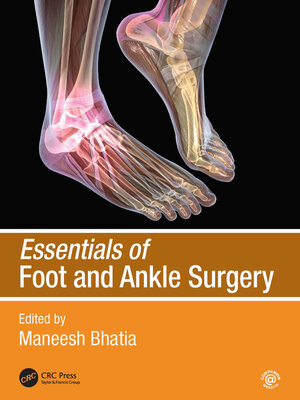 cover image of Essentials of Foot and Ankle Surgery
